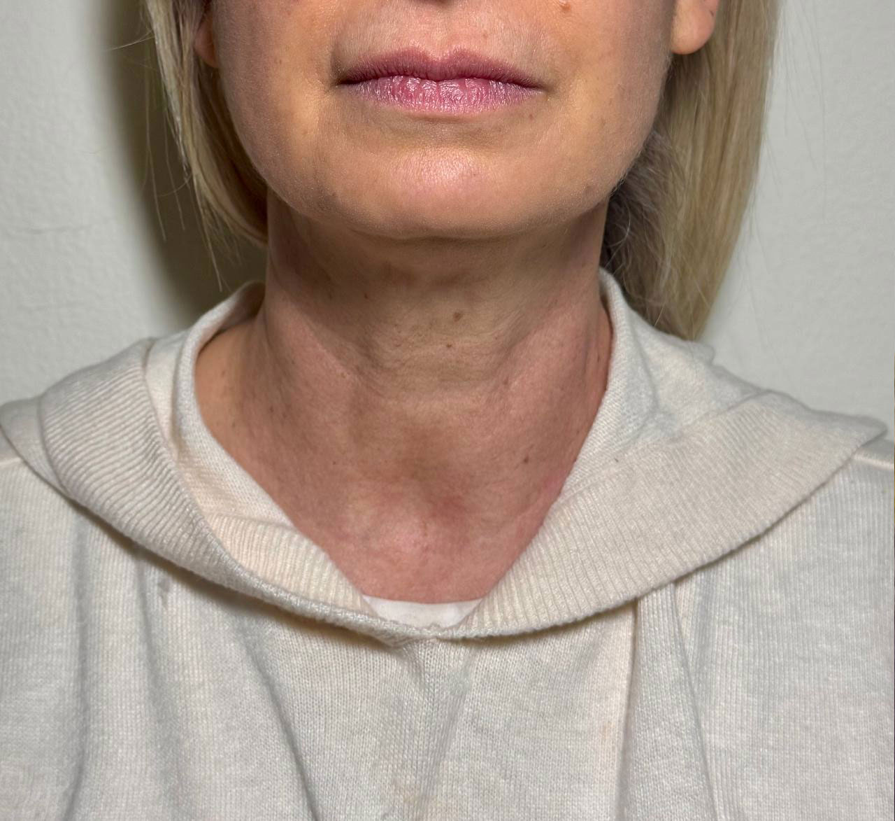 PRIMA